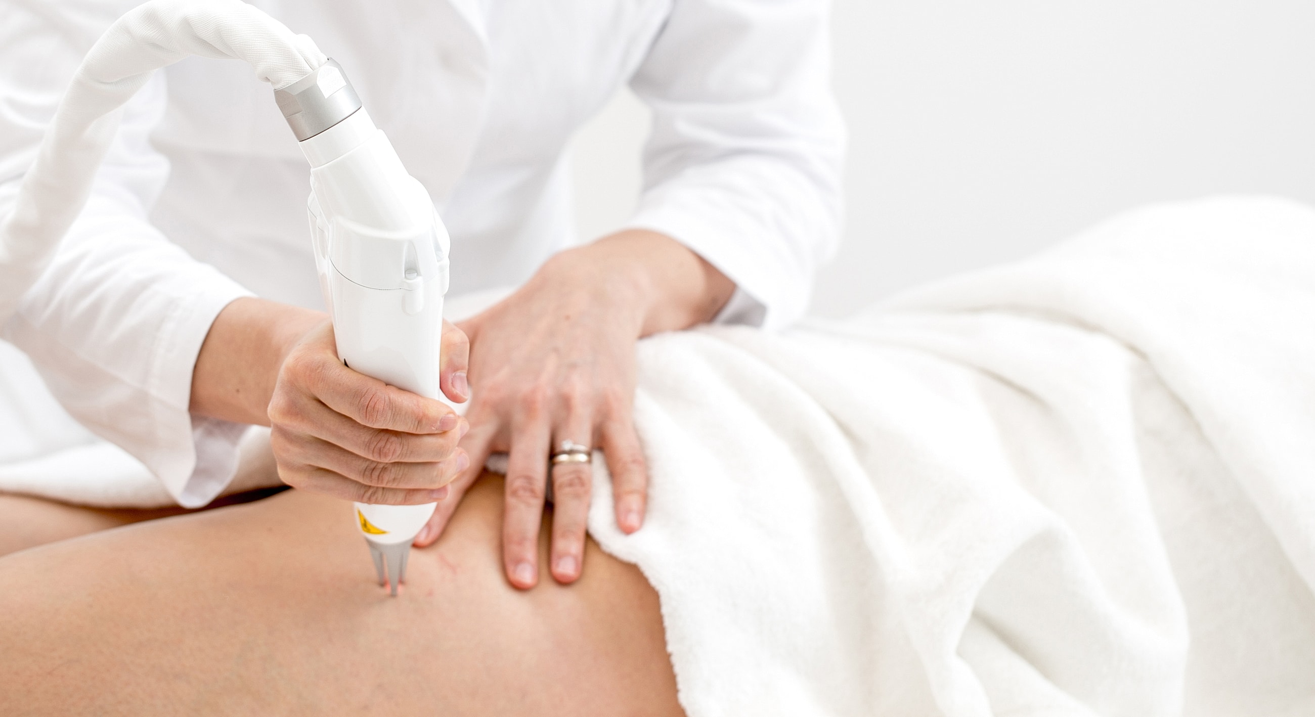 Laser treatment session on a patient's thigh.