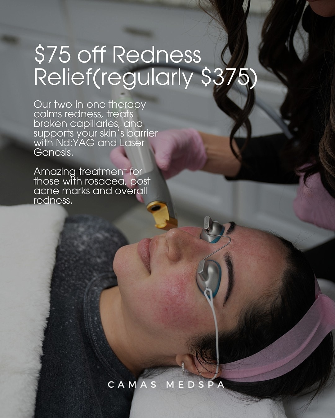 Laser treatment for redness relief at Camas Medspa.